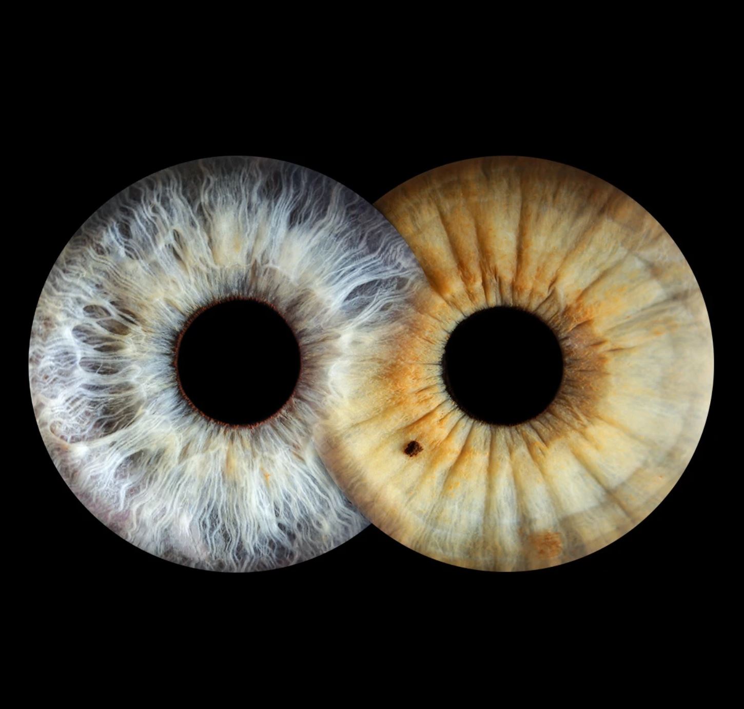 Парное фото радужки глаза